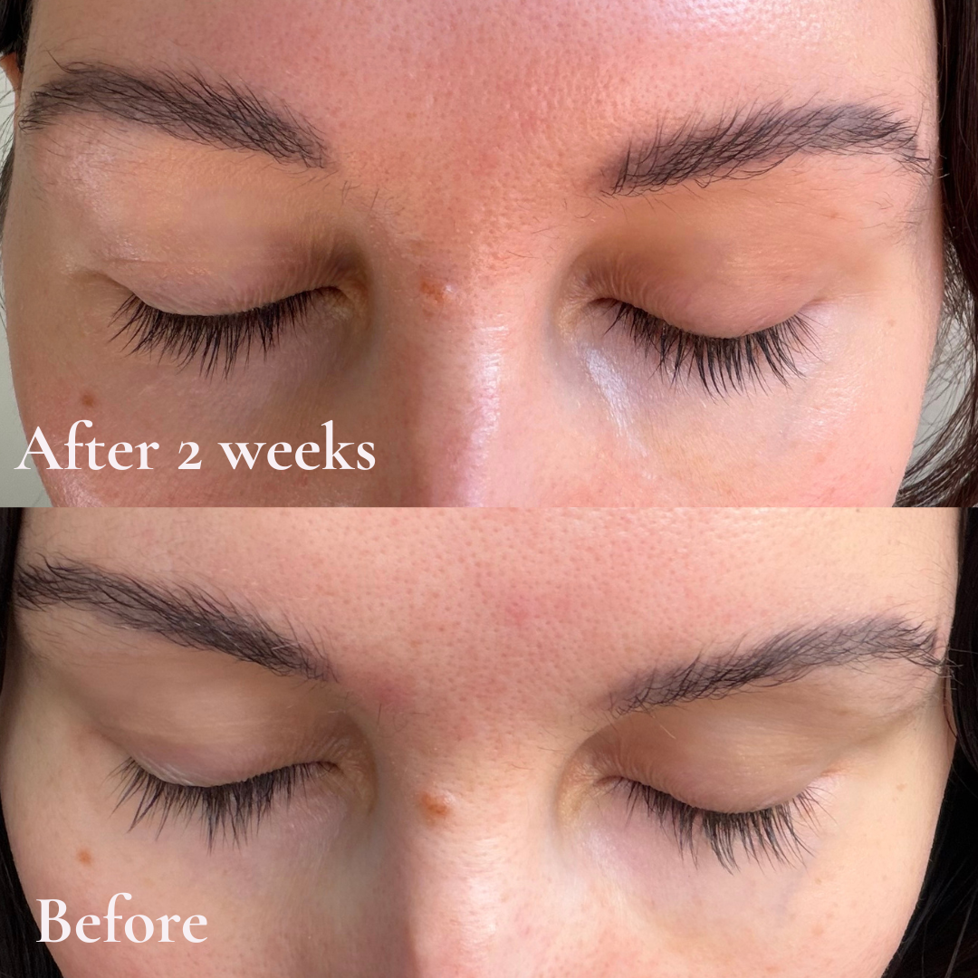 Wolfe Peptide Lash Serum before and after results